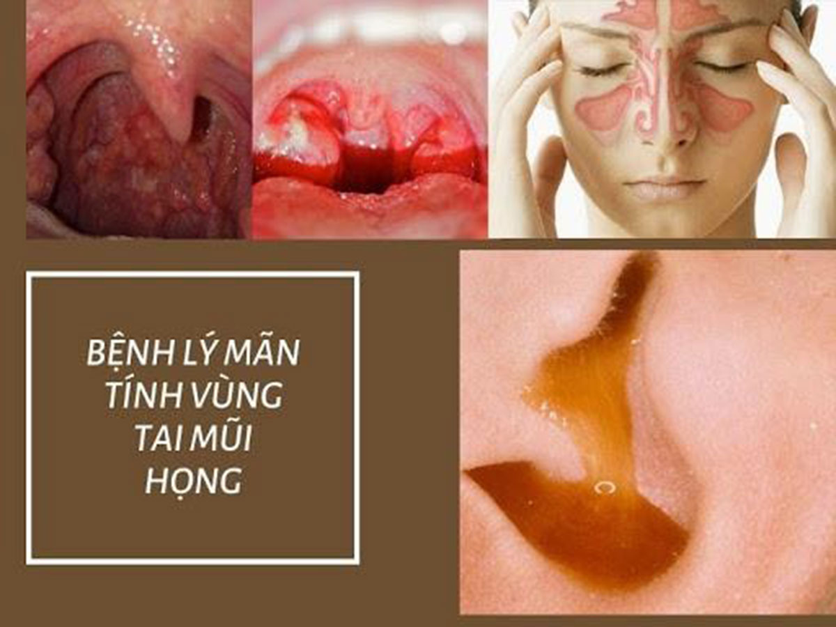 ung-thu-vom-hong_14