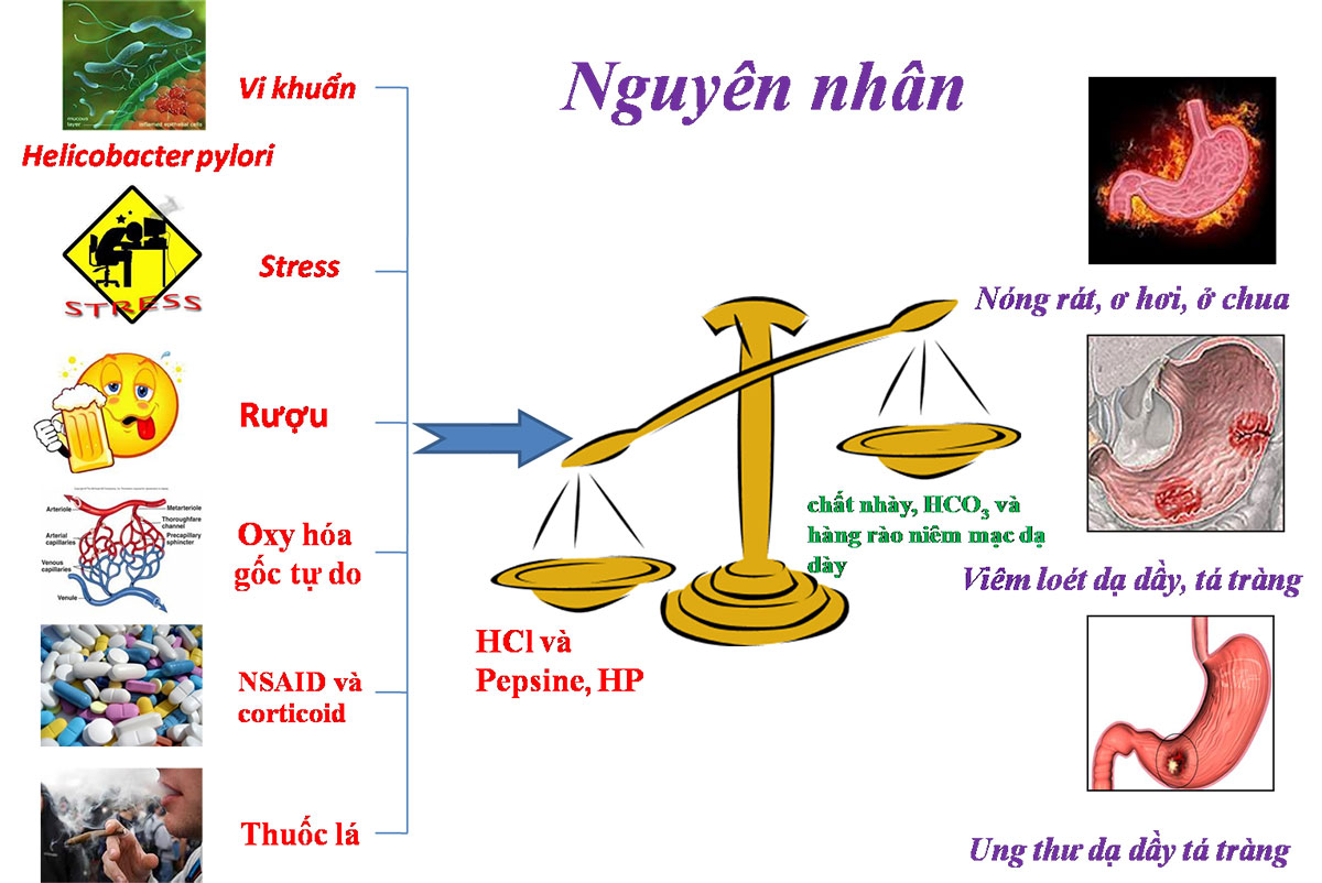 nguyen-nhan-gay-viem-loet-da-day_1