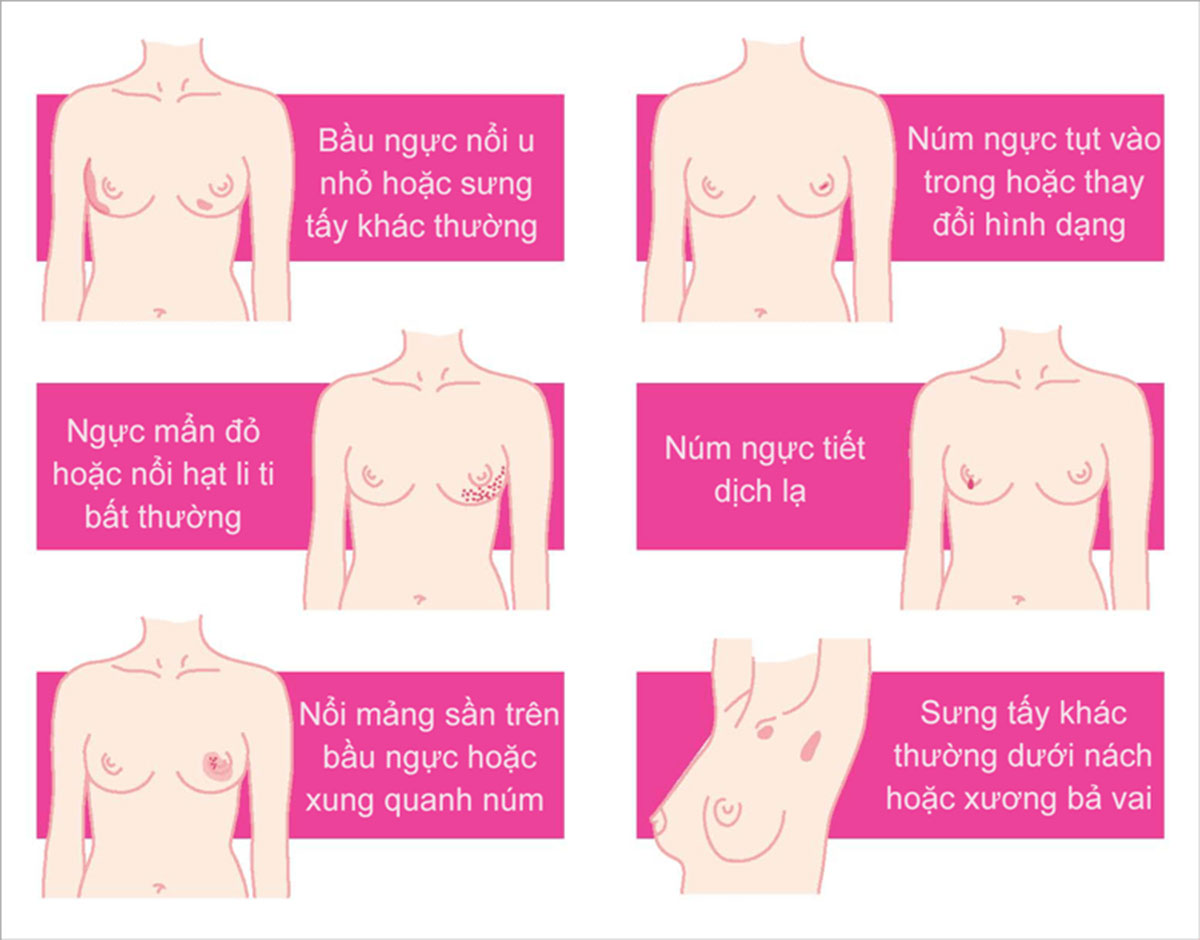 dau-hieu-nhan-biet-ung-thu-vu_15