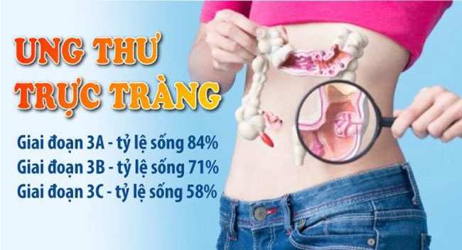 ung-thu-truc-trang-giai-doan-3_2