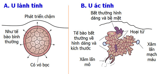 u-lanh-tinh-va-u-ac-tinh-3