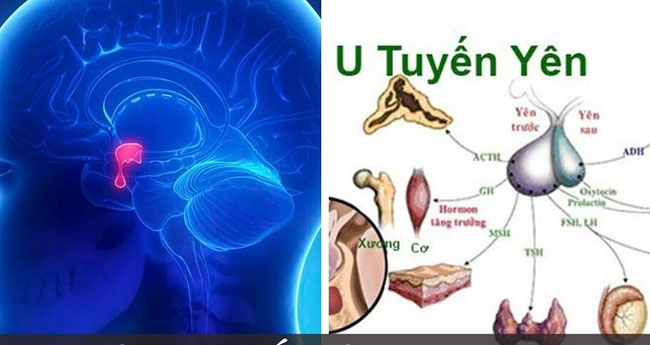 u-tuyen-yen-ac-tinh-1