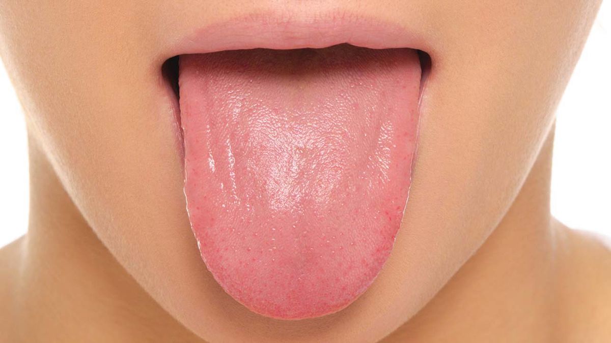 Tìm hiểu về ung thư lưỡi