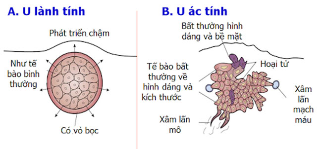 u-lanh-tinh-co-nen-mo-khong-1