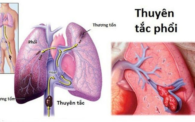 thuyen-tac-phoi