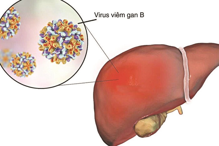 viem-gan-b-cap-tinh-la-gi