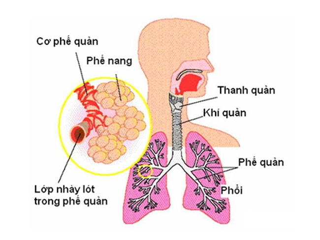 viem-phe-quan-phoi